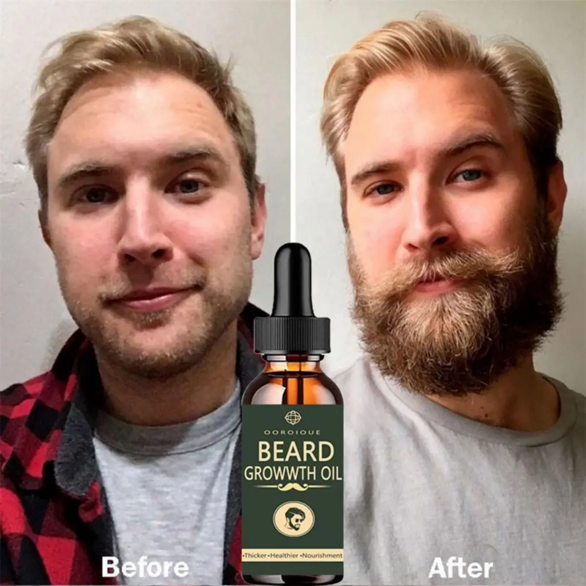Epidermal Growth Factor - Fast Beard Growth Oil Beard Oil