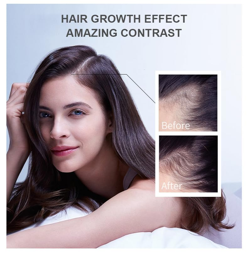 Hair Growth Oil Ginger Biotin  - Epidermal Growth Factor ulasan dan harga
