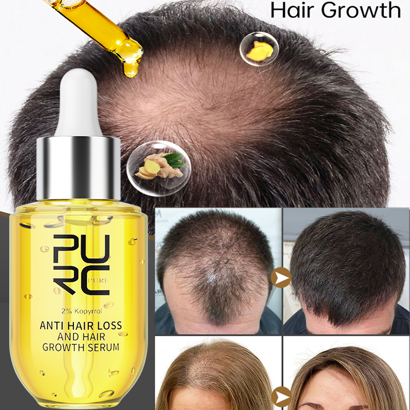 PURC Hair Growth Serum for Men - Epidermal Growth Factor ulasan dan harga