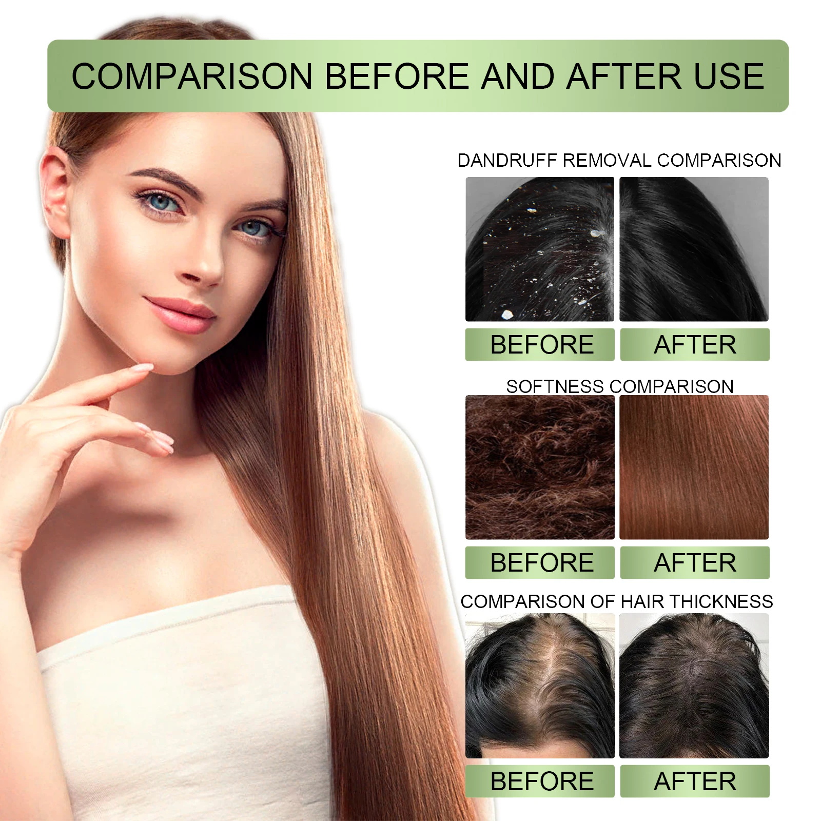 Fast Hair Growth Serum Spray A - Epidermal Growth Factor ulasan dan harga