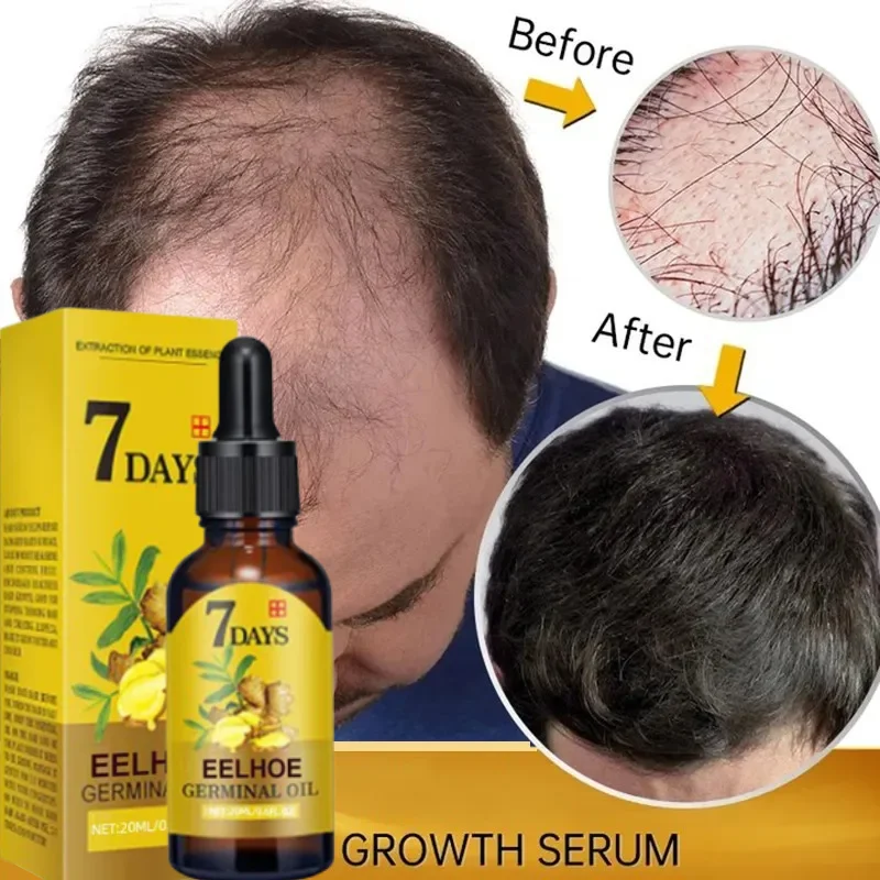 7 Day Fast Hair Growth Oil Gin - Epidermal Growth Factor ulasan dan harga