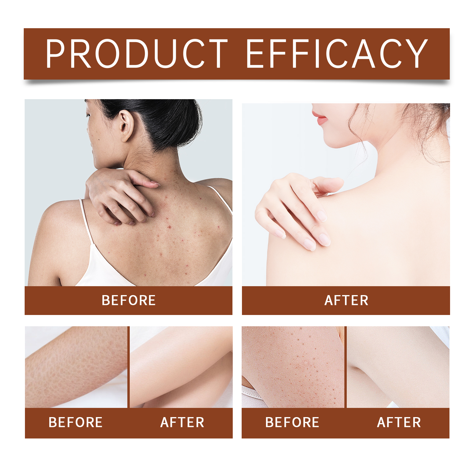 Luxury Body Oil for Dry Skin A - Luxury Skincare Gifts ulasan dan harga