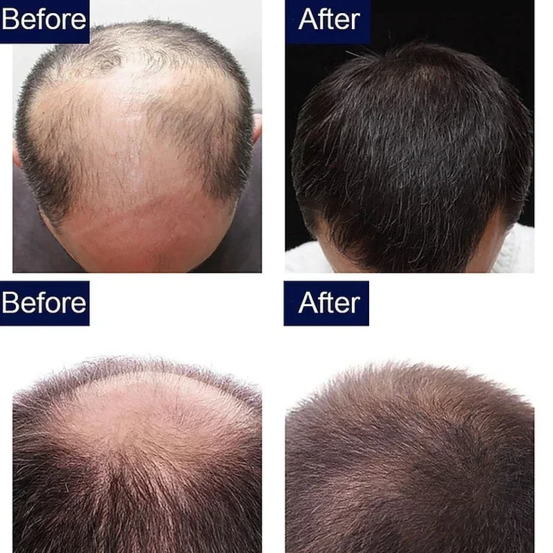 7 Day Fast Hair Growth Oil Gin - Epidermal Growth Factor ulasan dan harga
