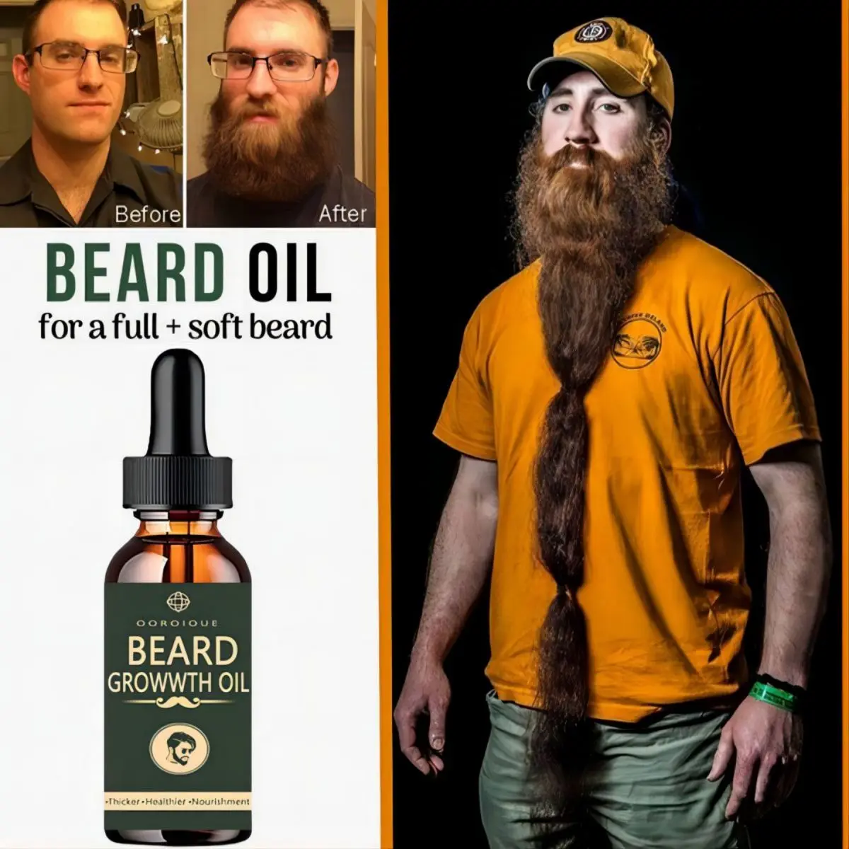 Fast Beard Growth Oil Beard Oi - Epidermal Growth Factor ulasan dan harga