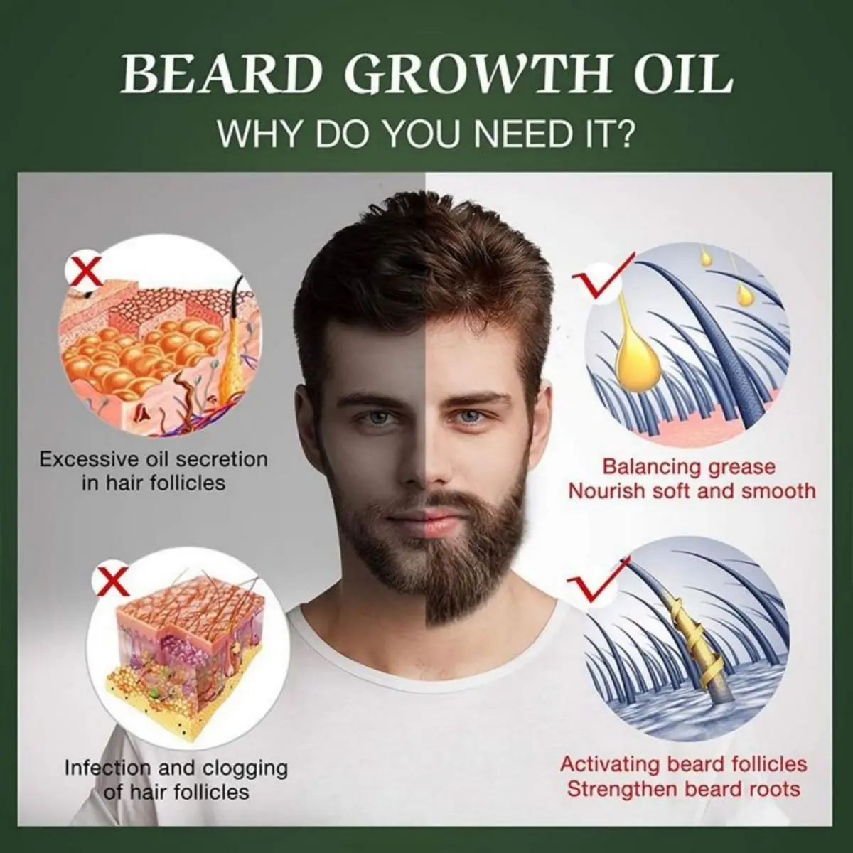 Fast Beard Growth Oil Beard Oi - Epidermal Growth Factor ulasan dan harga