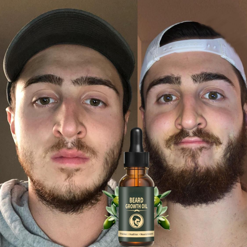 Fast Beard Growth Oil Beard Oi - Epidermal Growth Factor ulasan dan harga